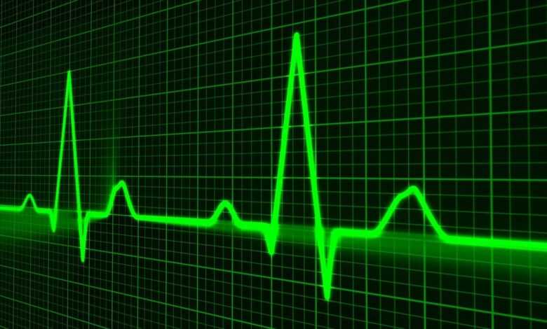 pulse trace, healthcare medicine, heartbeat, heart shape, medical equipment, equipment, symbol, graph, medical technical equipment, pulsating, medical supplies, wave pattern, computer graphic, monitoring equipment, heart beating, nobody, green computer, green heart, green laptop, green medical, green medicine, green pattern, green wave, green healthcare, green waves, green technical, heartbeat, heartbeat, heartbeat, heartbeat, graph, graph, graph, graph, graph