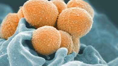 a close up of a bunch of balls on a cloth