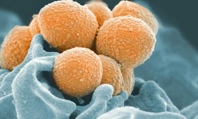 a close up of a bunch of balls on a cloth